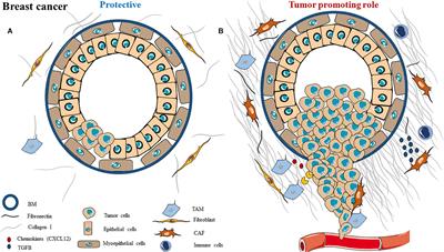 A Complex and Evolutive Character: Two Face Aspects of ECM in Tumor Progression